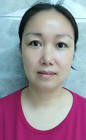 赵美琳